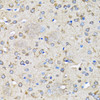 Immunohistochemistry of paraffin-embedded Rat brain using LC3B Polyclonal Antibody at dilution of  1:100 (40x lens).