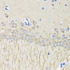 Immunohistochemistry of paraffin-embedded Mouse brain using LC3B Polyclonal Antibody at dilution of  1:100 (40x lens).
