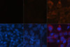 Immunofluorescence analysis of LC3B knockout 293T cells treated by chloroquine (top left) and wild-type 293T cells (top middle)，wild-type 293T cells treated by chloroquine (top right) using LC3B Polyclonal Antibody at dilution of  1:100. Blue: DAPI for nuclear staining.