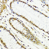 Immunohistochemistry of paraffin-embedded Human colon using CTCF Polyclonal Antibody at dilution of  1:100 (40x lens).