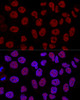 Confocal immunofluorescence analysis of Hela cells using CTCF Polyclonal Antibody at dilution of  1:200. Blue: DAPI for nuclear staining.