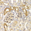 Immunohistochemistry of paraffin-embedded Rat kidney using ASC / TMS1 Polyclonal Antibody at dilution of  1:100 (40x lens).