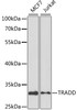 Western blot analysis of extracts of various cell lines using TRADD Polyclonal Antibody at dilution of 1:1000.