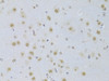Immunohistochemistry of paraffin-embedded Rat brain using CDKN1A Polyclonal Antibody at dilution of  1:100 (40x lens).