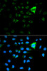 Immunofluorescence analysis of MCF-7 cells using CDKN1A Polyclonal Antibody