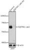 Western blot analysis of extracts from normal (control) and SQSTM1 / p62 knockout (KO) 293T cells using SQSTM1 / p62 Polyclonal Antibody at dilution of 1:1000.