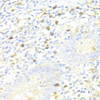 Immunohistochemistry of paraffin-embedded Human appendix using SQSTM1 / p62 Polyclonal Antibody at dilution of  1:100 (40x lens).