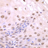 Immunohistochemistry of paraffin-embedded Human esophagus using SQSTM1 / p62 Polyclonal Antibody at dilution of  1:100 (40x lens).