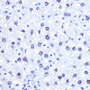 Immunohistochemistry of paraffin-embedded Rat liver using CHD4 Polyclonal Antibody at dilution of  1:100 (40x lens).