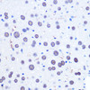 Immunohistochemistry of paraffin-embedded Mouse liver using CHD4 Polyclonal Antibody at dilution of  1:100 (40x lens).