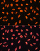 Immunofluorescence analysis of U20S cells using CHD4 Polyclonal Antibody at dilution of  1:100. Blue: DAPI for nuclear staining.