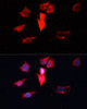 Immunofluorescence analysis of HeLa cells using CALM3 Polyclonal Antibody at dilution of  1:100. Blue: DAPI for nuclear staining.