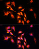 Immunofluorescence analysis of U-2 OS cells using LAMTOR1 Polyclonal Antibody at dilution of  1:100 (40x lens). Blue: DAPI for nuclear staining.