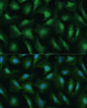Immunofluorescence analysis of U-2 OS cells using DDX3Y Polyclonal Antibody at dilution of  1:100 (40x lens). Blue: DAPI for nuclear staining.
