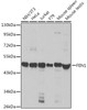 Western blot analysis of extracts of various cell lines using FEN1 Polyclonal Antibody at dilution of 1:1000.