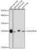 Western blot analysis of extracts of various cell lines using GADD45A Polyclonal Antibody at dilution of 1:1000.