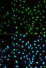 Immunofluorescence analysis of HeLa cells using NOXA2 / P67phox Polyclonal Antibody