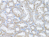 Immunohistochemistry of paraffin-embedded Rat kidney using Snail Polyclonal Antibody at dilution of  1:100 (40x lens).