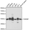 Western blot analysis of extracts of various cell lines using TARDBP Polyclonal Antibody at dilution of 1:1000.