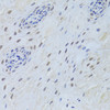 Immunohistochemistry of paraffin-embedded Human esophagus using TARDBP Polyclonal Antibody at dilution of  1:200 (40x lens).