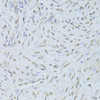 Immunohistochemistry of paraffin-embedded Human endometrium using TARDBP Polyclonal Antibody at dilution of  1:200 (40x lens).