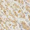 Immunohistochemistry of paraffin-embedded Human stomach using GGA2 Polyclonal Antibody at dilution of  1:200 (40x lens).