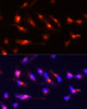 Immunofluorescence analysis of U-251MG cells using Nestin Polyclonal Antibody at dilution of  1:100 (20x lens). Blue: DAPI for nuclear staining.