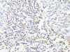 Immunohistochemistry of paraffin-embedded Human tonsil using Vimentin Polyclonal Antibody at dilution of  1:150 (40x lens).