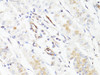 Immunohistochemistry of paraffin-embedded Human stomach using Vimentin Polyclonal Antibody at dilution of  1:150 (40x lens).