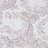 Immunohistochemistry of paraffin-embedded Mouse testis using KDM3A Polyclonal Antibody at dilution of  1:100 (40x lens).