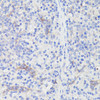 Immunohistochemistry of paraffin-embedded Mouse spleen using PD-1 Polyclonal Antibody at dilution of  1:200 (40x lens).