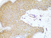 Immunohistochemistry of paraffin-embedded Human skin using PD-1 Polyclonal Antibody at dilution of  1:100 (40x lens).