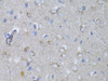 Immunohistochemistry of paraffin-embedded Rat brain using MYH10 Polyclonal Antibody at dilution of  1:100 (40x lens).