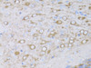 Immunohistochemistry of paraffin-embedded Mouse brain using MYH10 Polyclonal Antibody at dilution of  1:100 (40x lens).