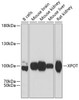 Western blot analysis of extracts of various cell lines using XPOT Polyclonal Antibody at dilution of 1:3000.