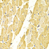 Immunohistochemistry of paraffin-embedded Rat heart using CA3 Polyclonal Antibody at dilution of  1:100 (40x lens).