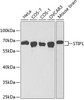 Western blot analysis of extracts of various cell lines using STIP1 Polyclonal Antibody at dilution of 1:1000.