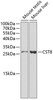 Western blot analysis of extracts of various cell lines using CST8 Polyclonal Antibody at dilution of 1:1000.