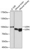 Western blot analysis of extracts of various cell lines using USP4 Polyclonal Antibody at dilution of 1:3000.
