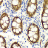Immunohistochemistry of paraffin-embedded Human colon using GIPC2 Polyclonal Antibody at dilution of  1:100 (40x lens).