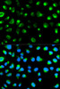 Immunofluorescence analysis of MCF-7 cells using GYPC Polyclonal Antibody