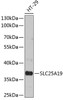 Western blot analysis of extracts of HT-29 cells using SLC25A19 Polyclonal Antibody at dilution of 1:3000.