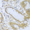 Immunohistochemistry of paraffin-embedded Human stomach using ACP1 Polyclonal Antibody at dilution of  1:100 (40x lens).