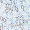 Immunohistochemistry of paraffin-embedded Rat kidney using C1 Inactivator Polyclonal Antibody at dilution of  1:100 (40x lens).
