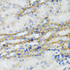 Immunohistochemistry of paraffin-embedded Mouse kidney using C1 Inactivator Polyclonal Antibody at dilution of  1:100 (40x lens).