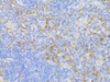 Immunohistochemistry of paraffin-embedded Mouse thymus using CD3E Antigen Polyclonal Antibody at dilution of  1:100 (40x lens).
