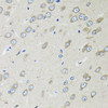 Immunohistochemistry of paraffin-embedded Rat brain using OGDH Polyclonal Antibody at dilution of  1:100 (40x lens).