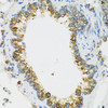 Immunohistochemistry of paraffin-embedded Rat lung using PI3 Polyclonal Antibody at dilution of  1:100 (40x lens).