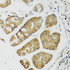 Immunohistochemistry of paraffin-embedded Human esophagus using PI3 Polyclonal Antibody at dilution of  1:100 (40x lens).