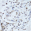 Immunohistochemistry of paraffin-embedded Human esophagus using PSMD13 Polyclonal Antibody at dilution of  1:100 (40x lens).